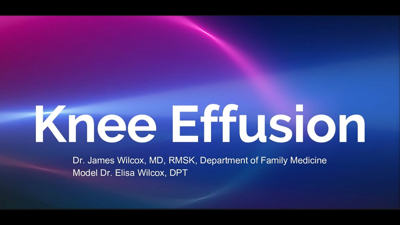 Evaluation for Knee Effusion