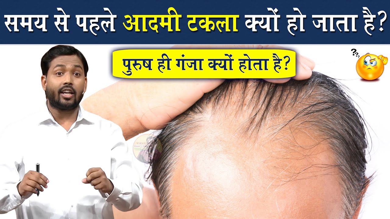आदमी गंजा क्यों हो जाता है? गंजेपन का रामबाण इलाज | Viral Khan Sir