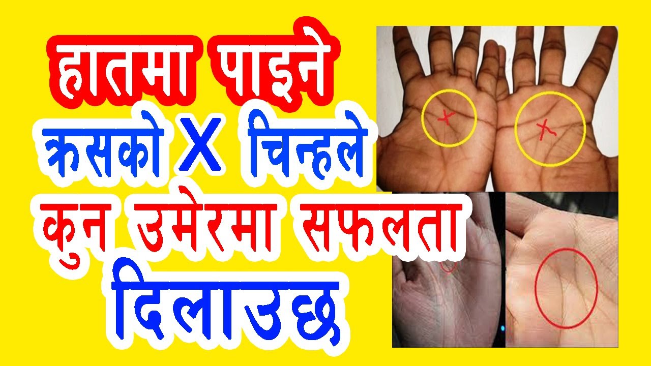 हातमा पाइने क्रसको X चिन्हले  तपाइको कुन उमेरमा प्रगति गराउछ । Letter X in Hand Cross Sign In Hand.