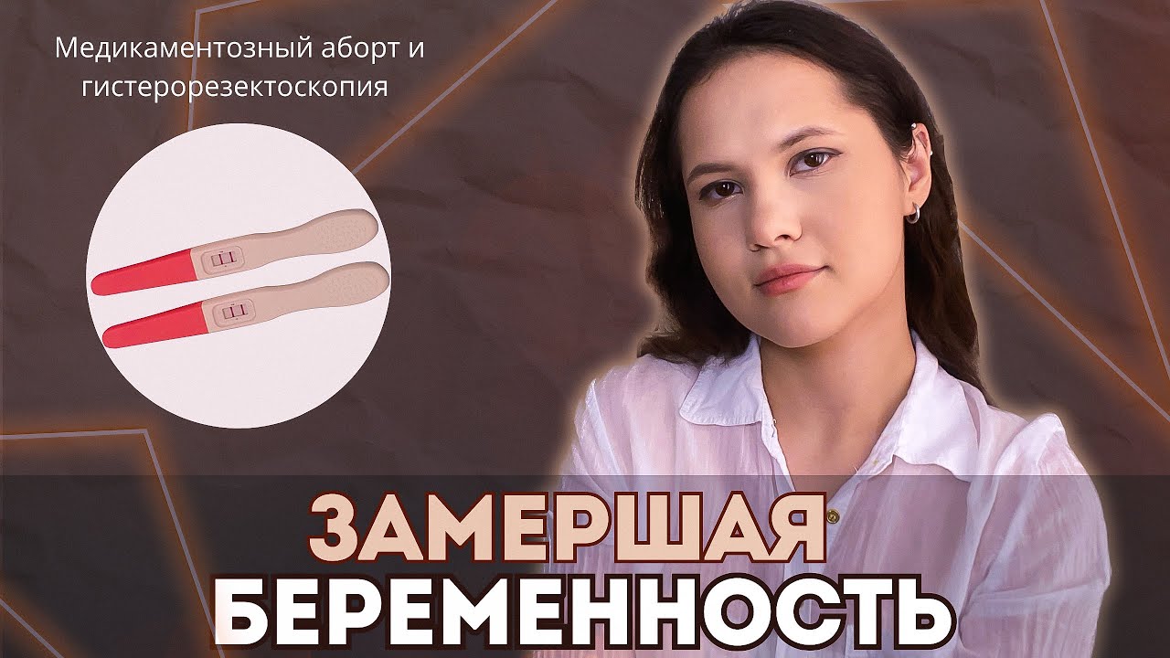 Моя ЗАМЕРШАЯ БЕРЕМЕННОСТЬ. Медикаментозный аборт и гистерорезектоскопия