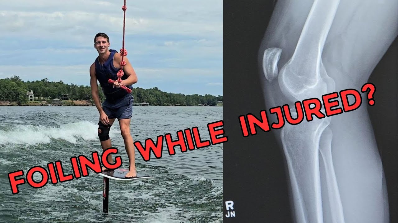 Can You Foil With A Knee Injury?