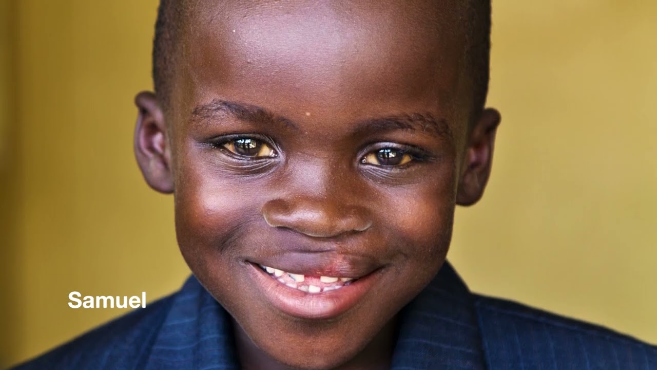 Operation Smile and Peanut RUTF
