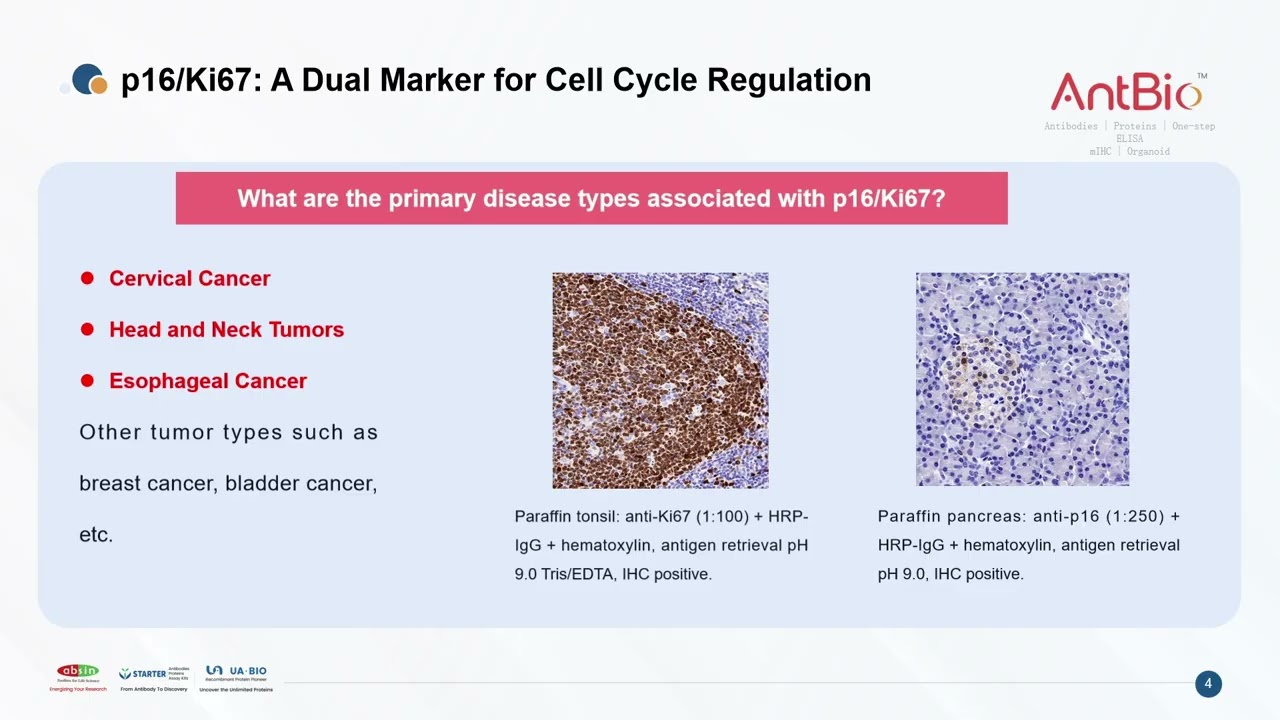 p16/Ki67: A Dual Marker for Cell Cycle Regulation