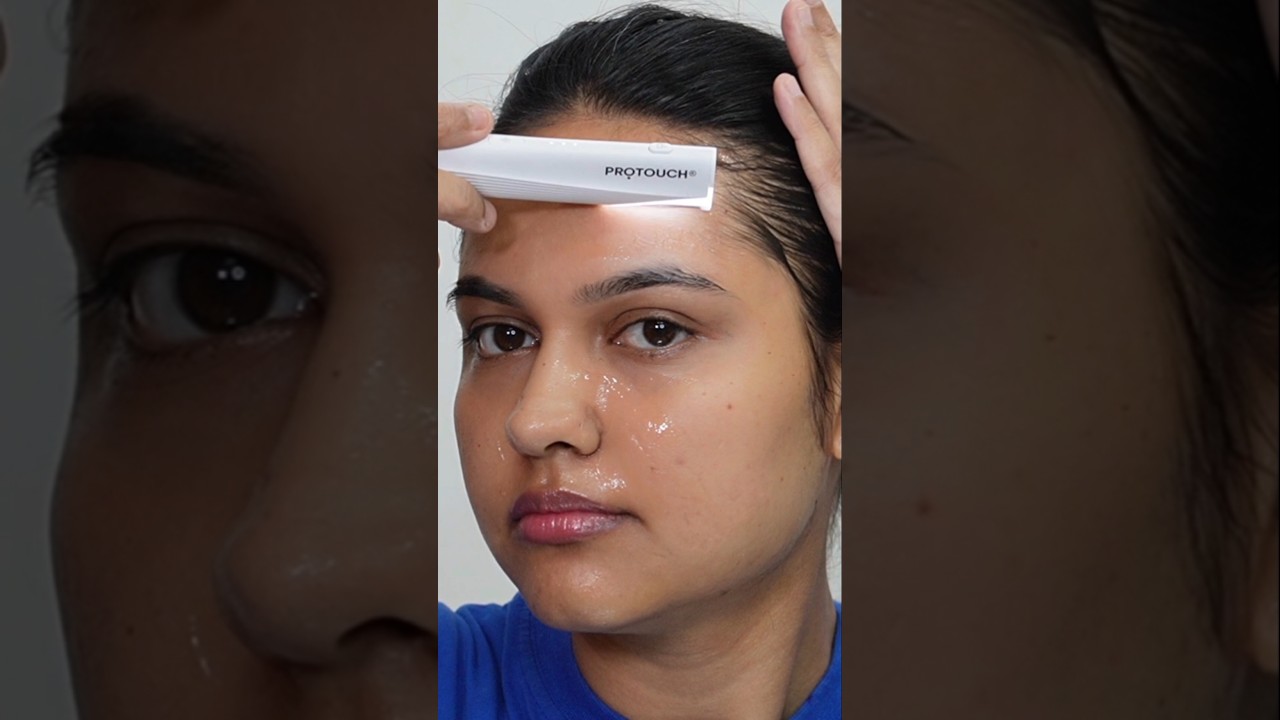 Kya Face Shave Karne Se Maire Mote Baal Aye 🙃🌷 #dermaplaning #faceshaveathome #protouch #shorts