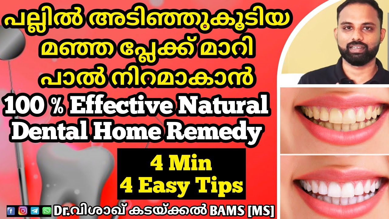 💯% പല്ല് വെളുപ്പിക്കാം | Teeth whitening at home |Teeth cleaning| How to remove yellow teeth at home