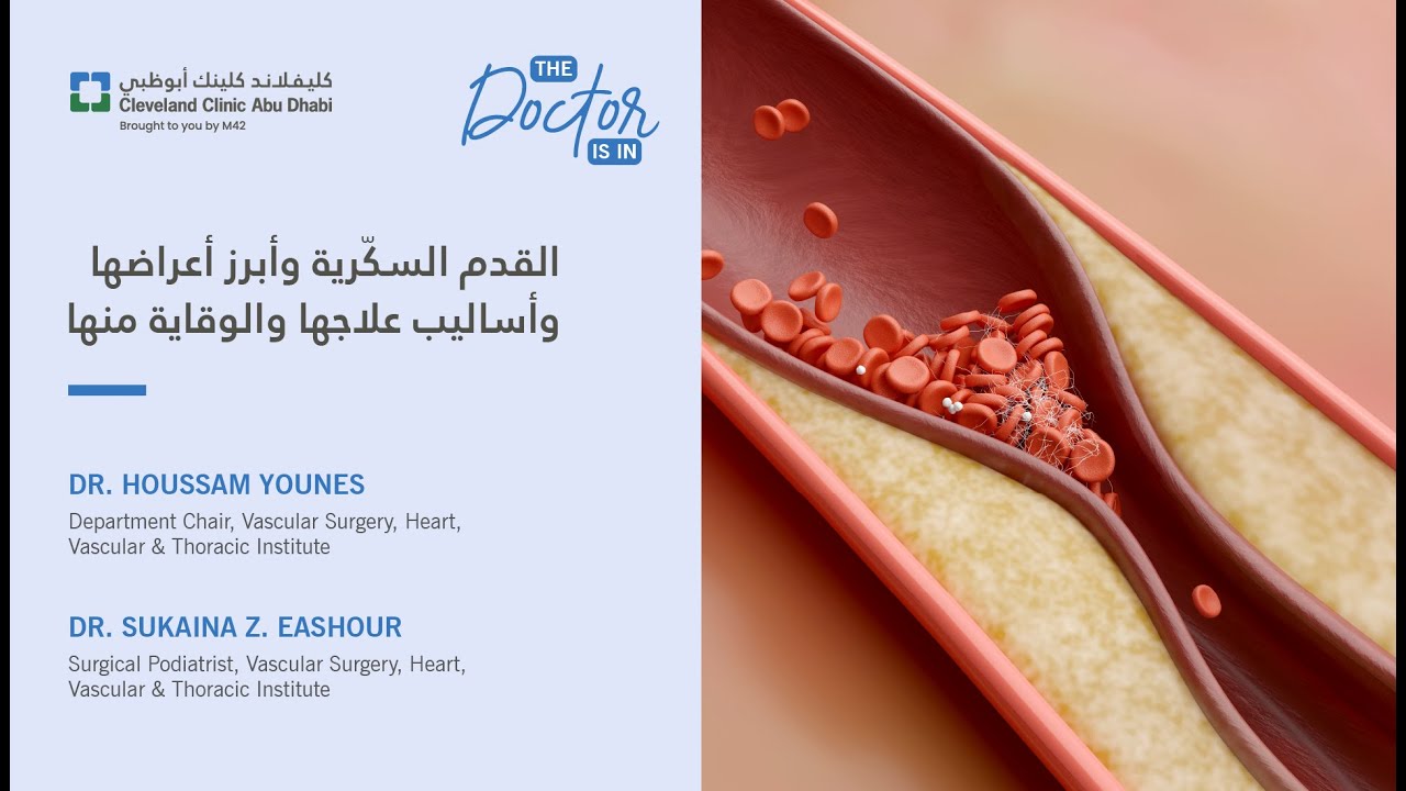 القدم السكّرية وأبرز أعراضها وأساليب علاجها والوقاية منها