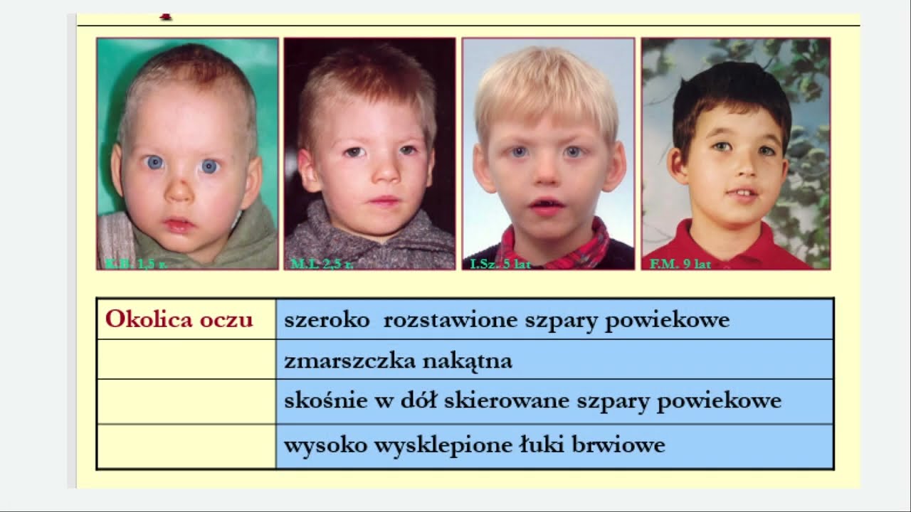 Zesp&oacute;ł delecji 5p dawniej i dziś - dr Renata Posmyk - G&oacute;ra św. Anny -czerwiec 2023