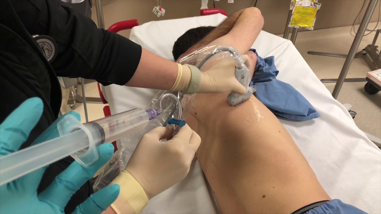 Serratus Anterior Regional Anesthesia