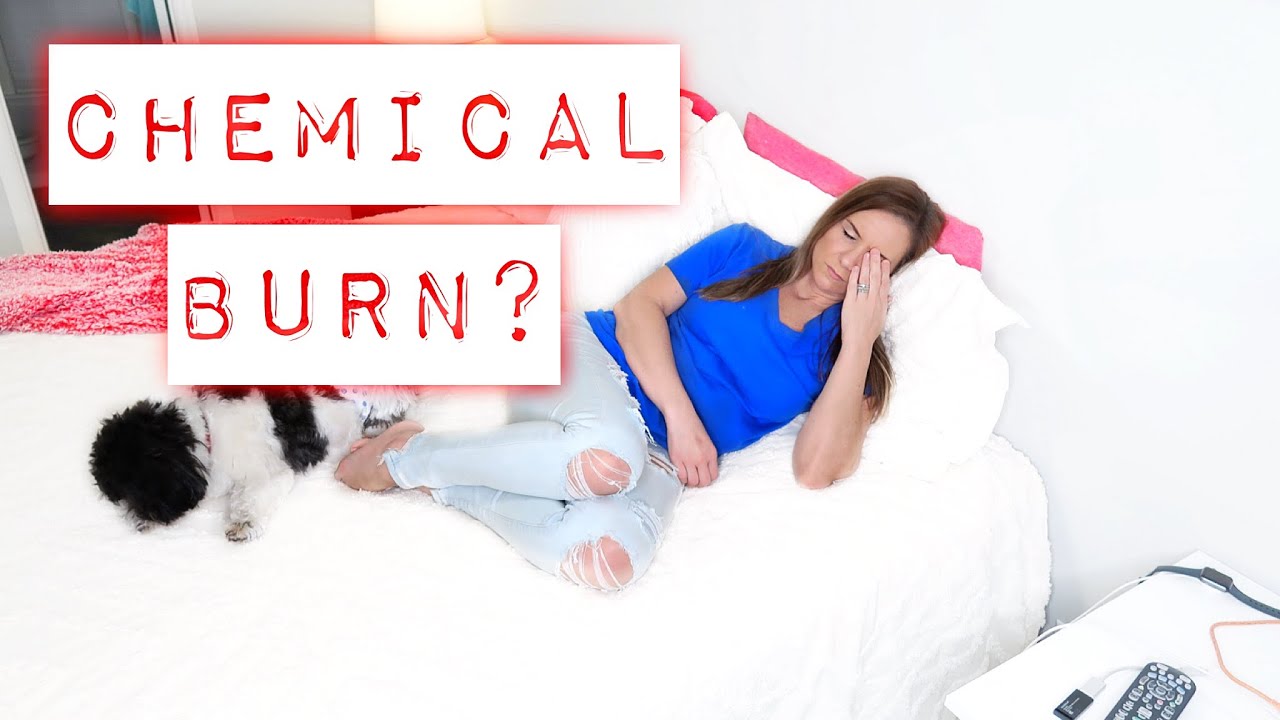 SEVERE ALLERGIC REACTION  | Family 5 Vlogs