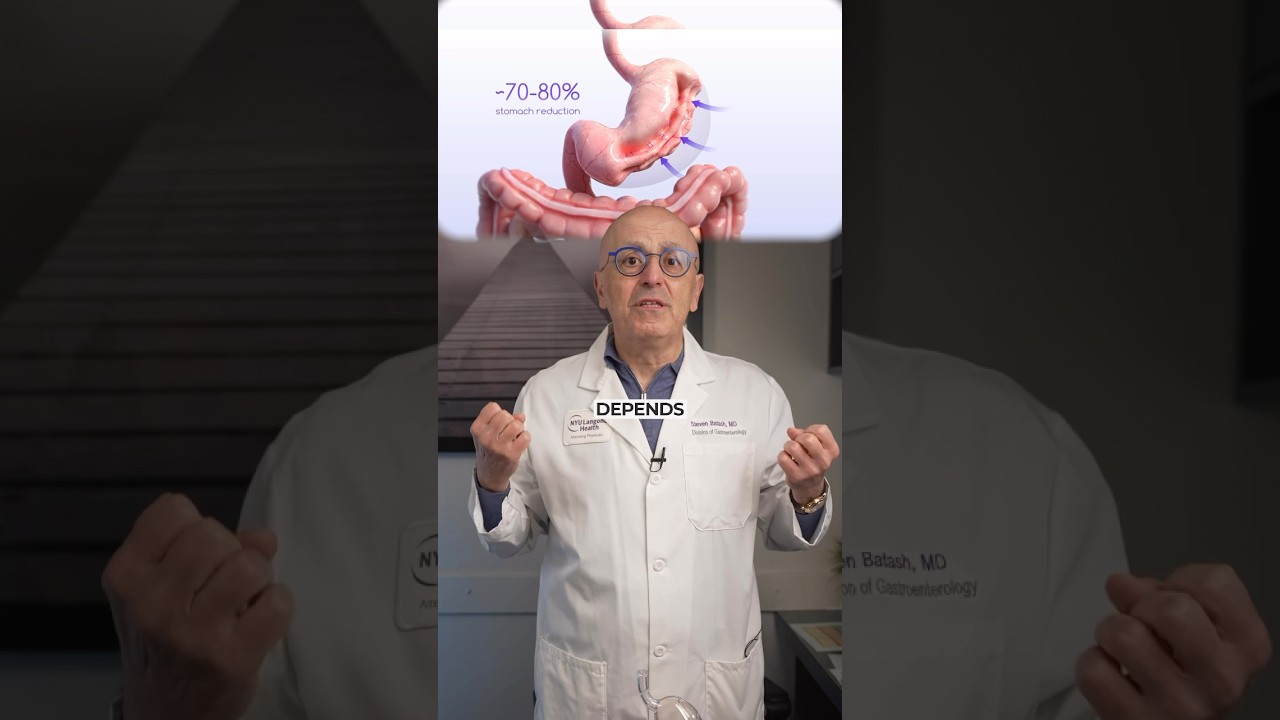 Gastric Balloon vs Endoscopic Sleeve - How to decide which procedure is better for you