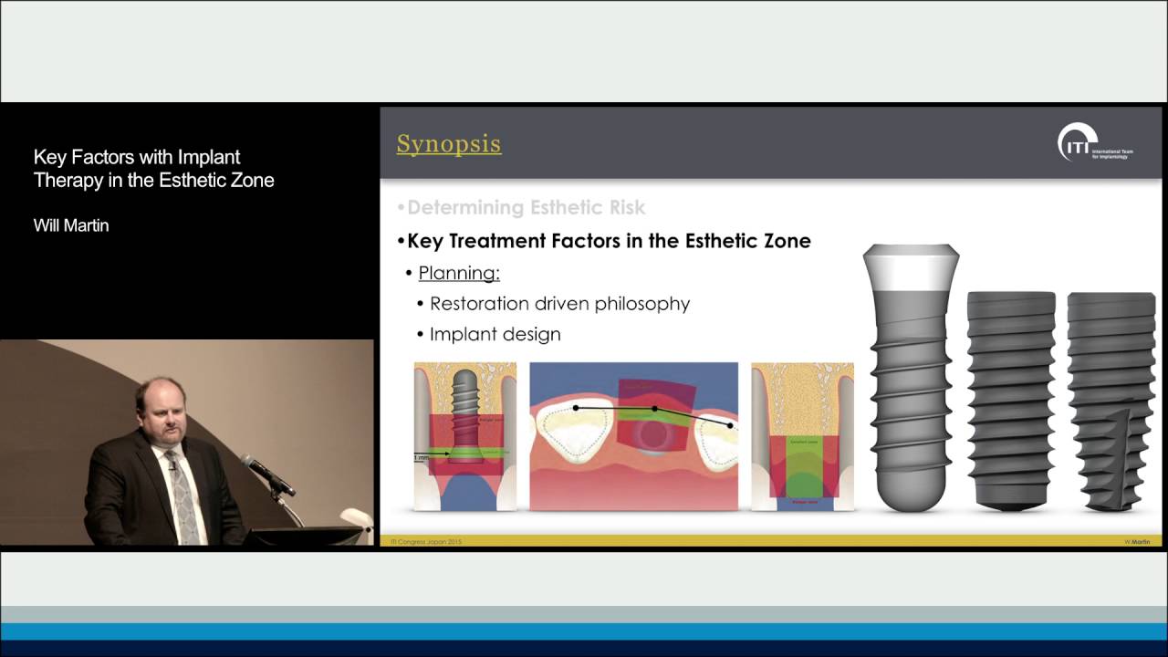 Key Factors with Implant Therapy in the Esthetic Zone | William Christopher Martin