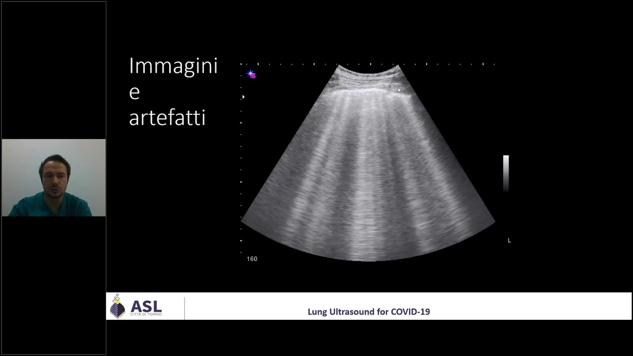 Ecografia polmonare per le USCA 3 - Segni di base