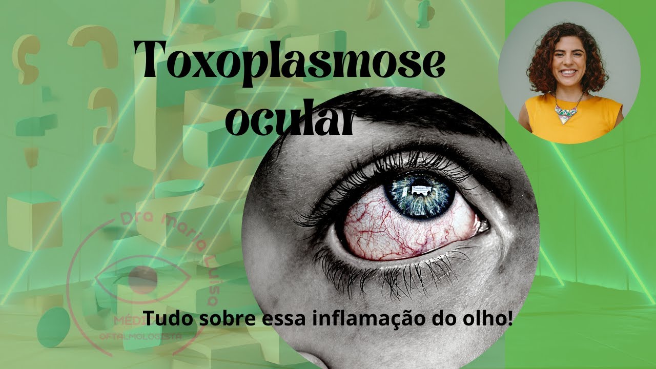 TOXOPLASMOSE OCULAR - Tudo que voc&ecirc; precisa saber