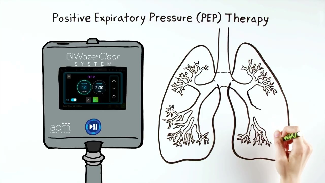 BiWaze® Clear Hospital Animation - A patient story