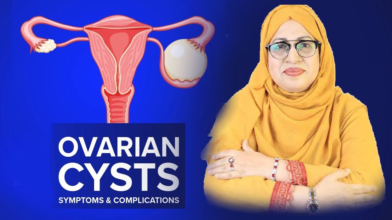 Ovarian Cyst, Types - Causes & Symptoms - Dr Samina Toufeeq Gynaecologist