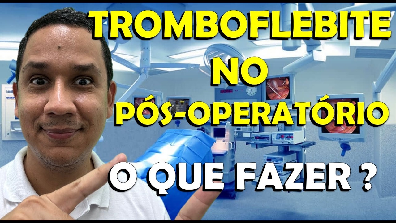 Perna inchada após cirurgia? Pode ser Tromboflebite! Sintomas, prevenção e tratamento.