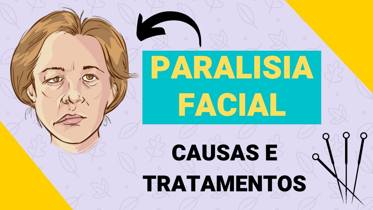 ACUPUNTURA PARA PARALISIA FACIAL - Etiopatogenia  e Tratamento através da Medicina Chinesa