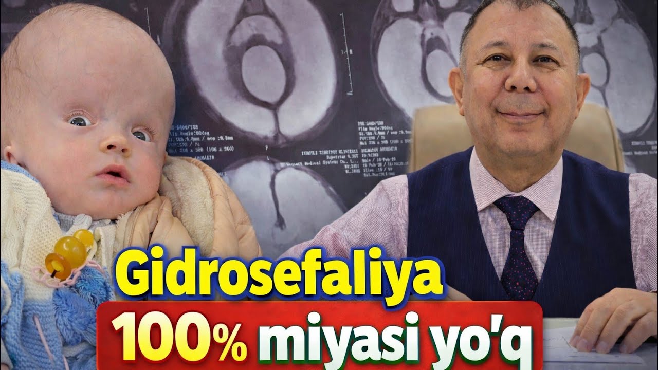 Gidrosefaliya.100% miyasi yo'q. Bir kundagi shu tashxis bilan kelgan 4- bemor.