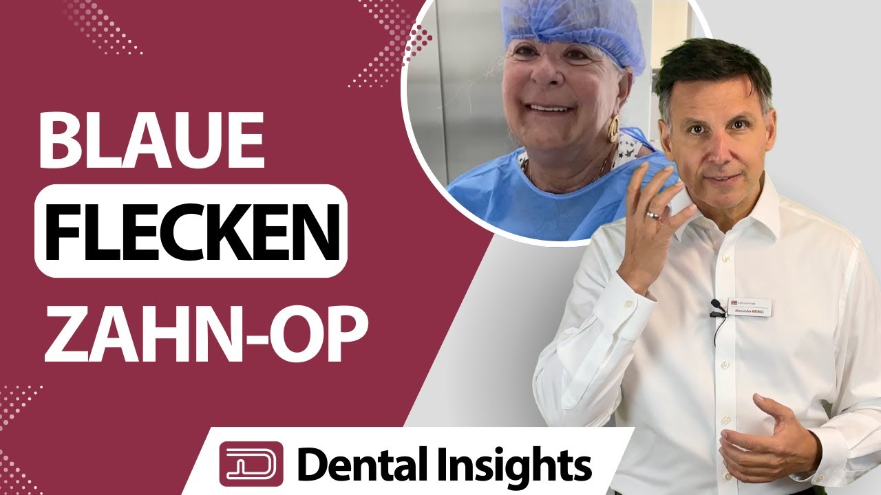 Hilfe! Blaue Flecken im Gesicht nach der Implantation!