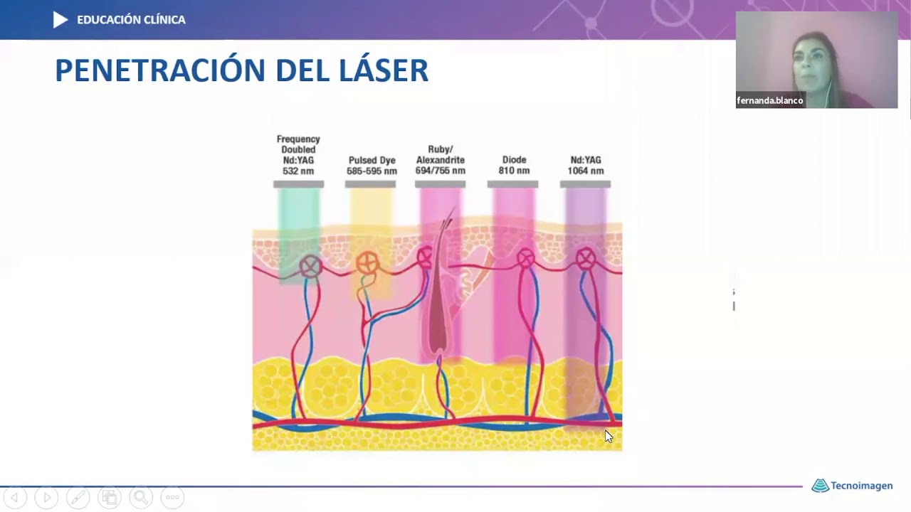 Webinar: Aspectos clínicos para el tratamiento de Depilación Láser