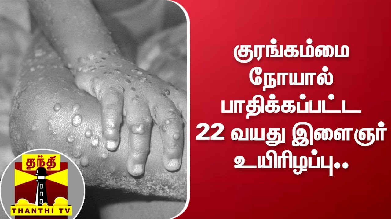அதிர்ச்சி தகவல்.. குரங்கம்மை நோயால் பாதிக்கப்பட்ட 22 வயது  இளைஞர் உயிரிழப்பு.. | Monkeypox | Kerala