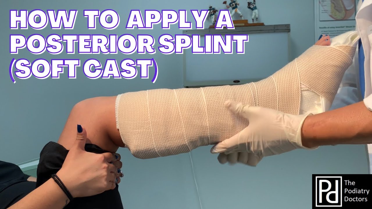 How to Apply a Posterior Splint (Soft cast)