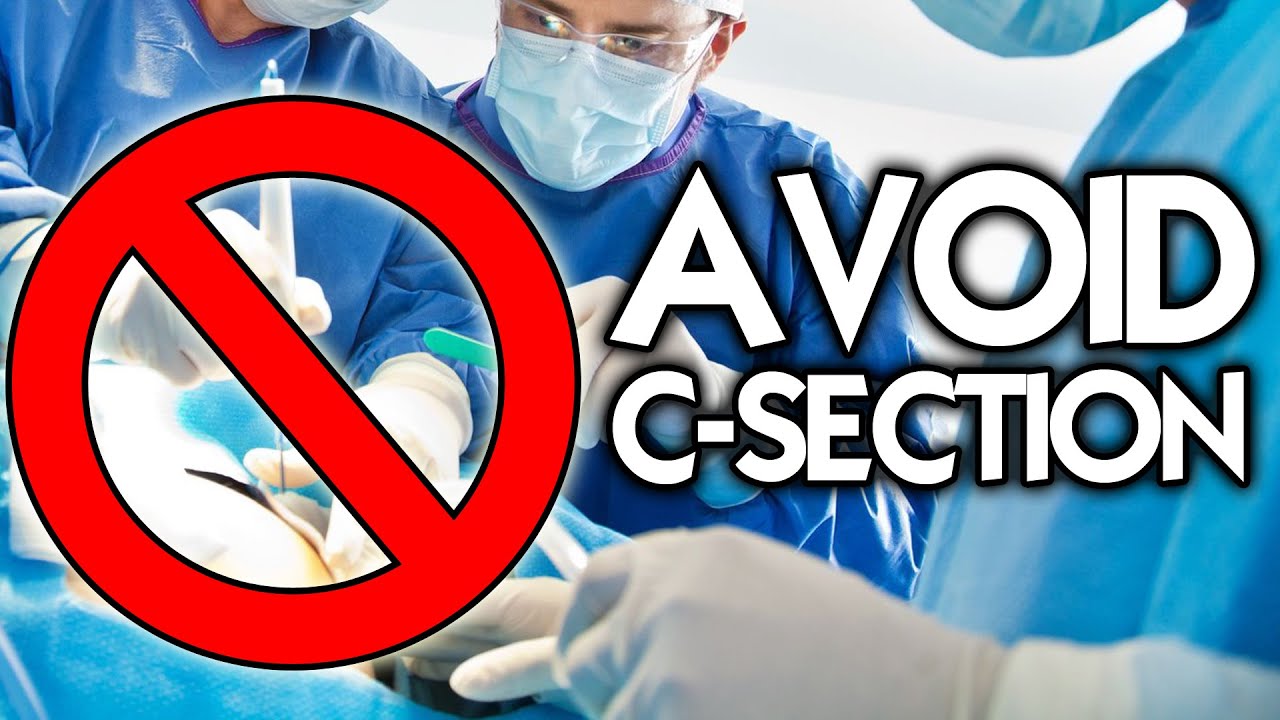 Top 10 Tips to Avoid a C-Section | Midwife Secrets You Need to Know