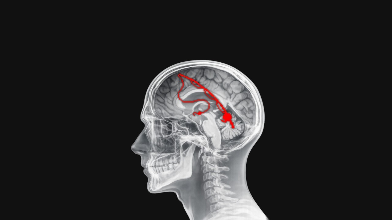Das EINZIGE Video zum Thema Mindset shifting, das du jemals brauchen wirst