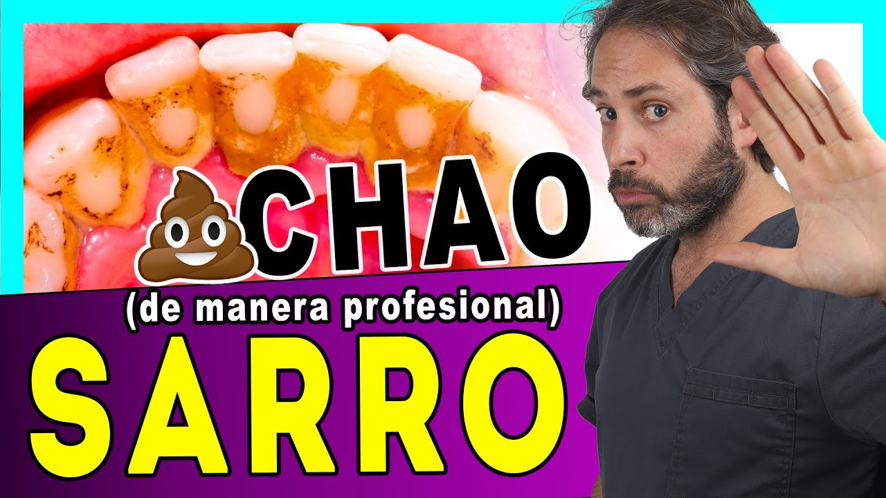Te 𝙀𝙭𝙥𝙡𝙞𝙘𝙤 como 𝗤𝗨𝗜𝗧𝗔𝗥 el 𝗦𝗔𝗥𝗥𝗢 💩 de los DIENTES . Así LIMPIAN los DIENTES los DENTISTAS (3 𝗠𝗲𝘁𝗼𝗱𝗼𝘀)