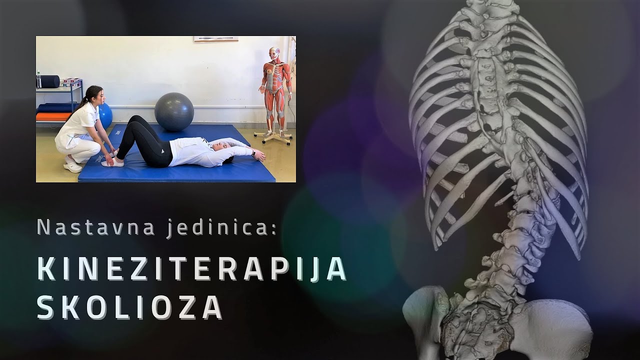 Kineziterapija skolioza - Medicinska škola u Rijeci