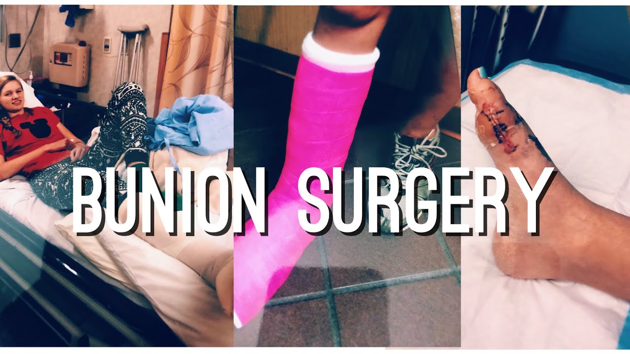 BUNION SURGERY Part 1| STORYTIME | Grace Jennings