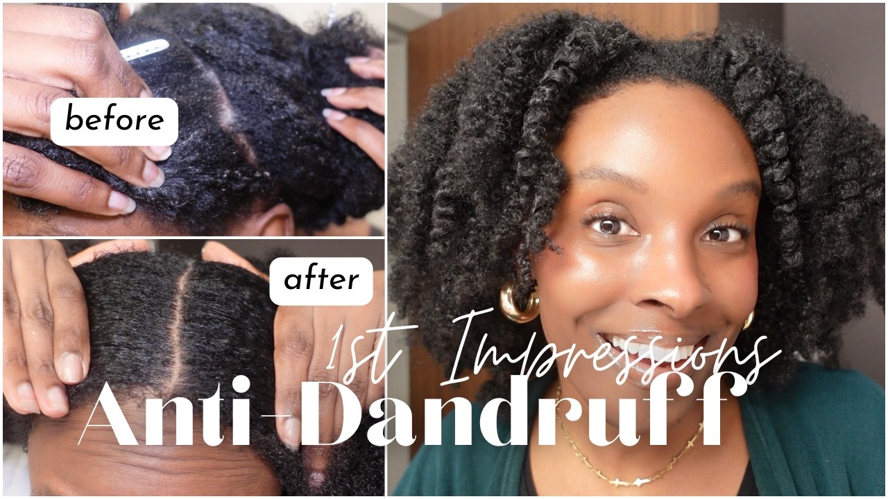 I Have A Flaky Scalp So I Tried A French Anti-Dandruff Line | Type 4 Twist-Out