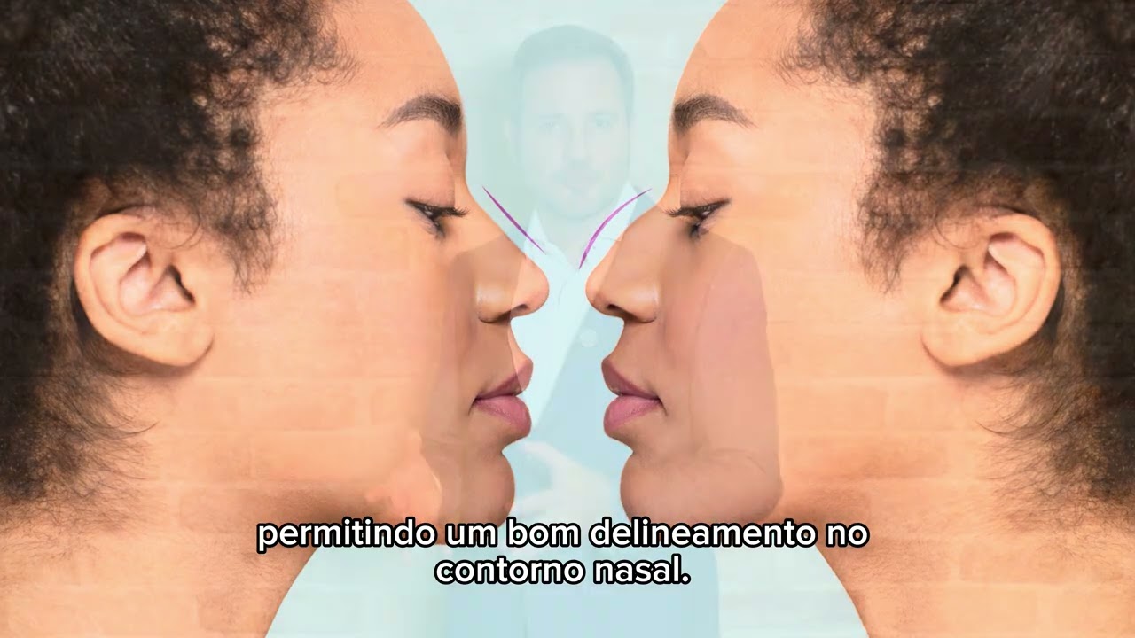 Rinoplastia | Entenda sua evolução ao longo dos anos