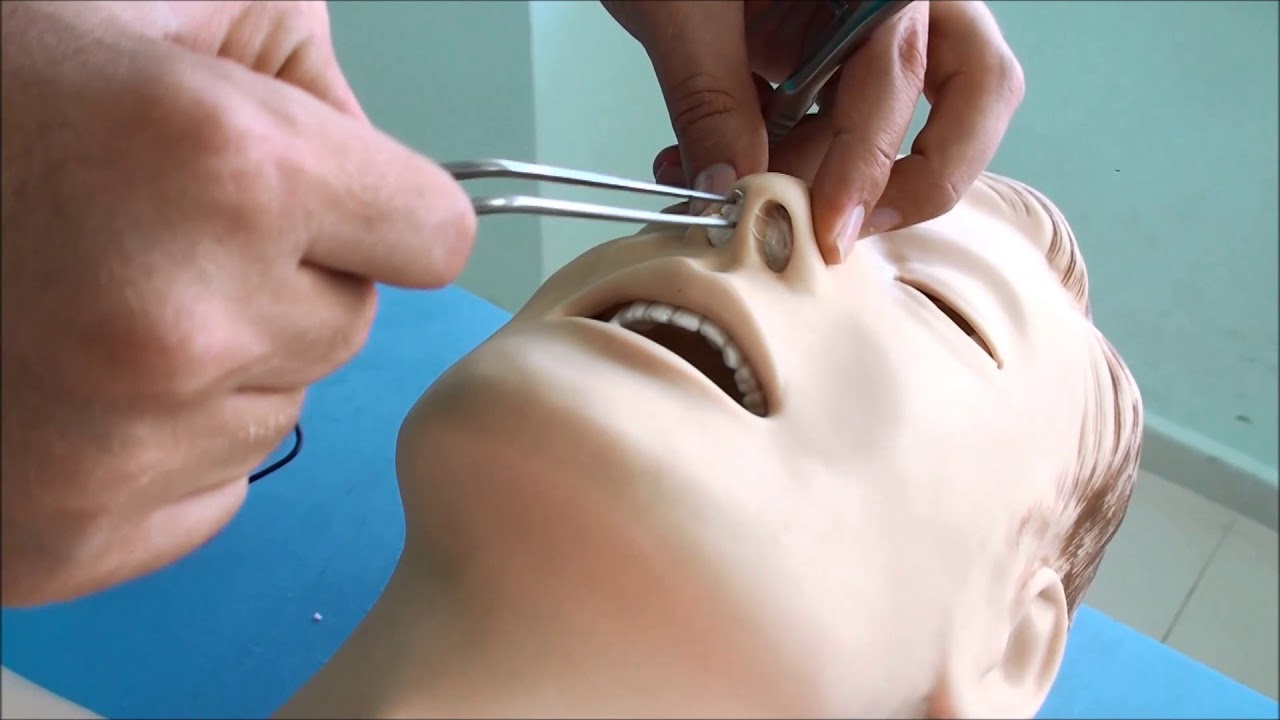 anterior tampon