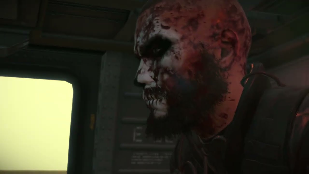 MGSV FOB PvP RoguePatriot_08 vs zidane_012