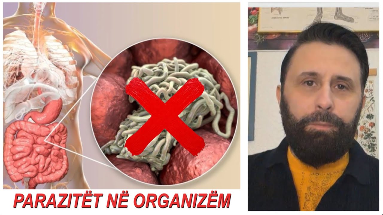 PARAZITËT po na vrasin! Ja si t’i ZHDUKIM nga trupi / 2 këshilla nga Altin Joka