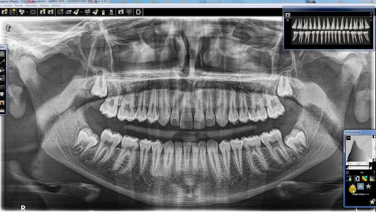 How to use CS Adapt for Panoramic Images
