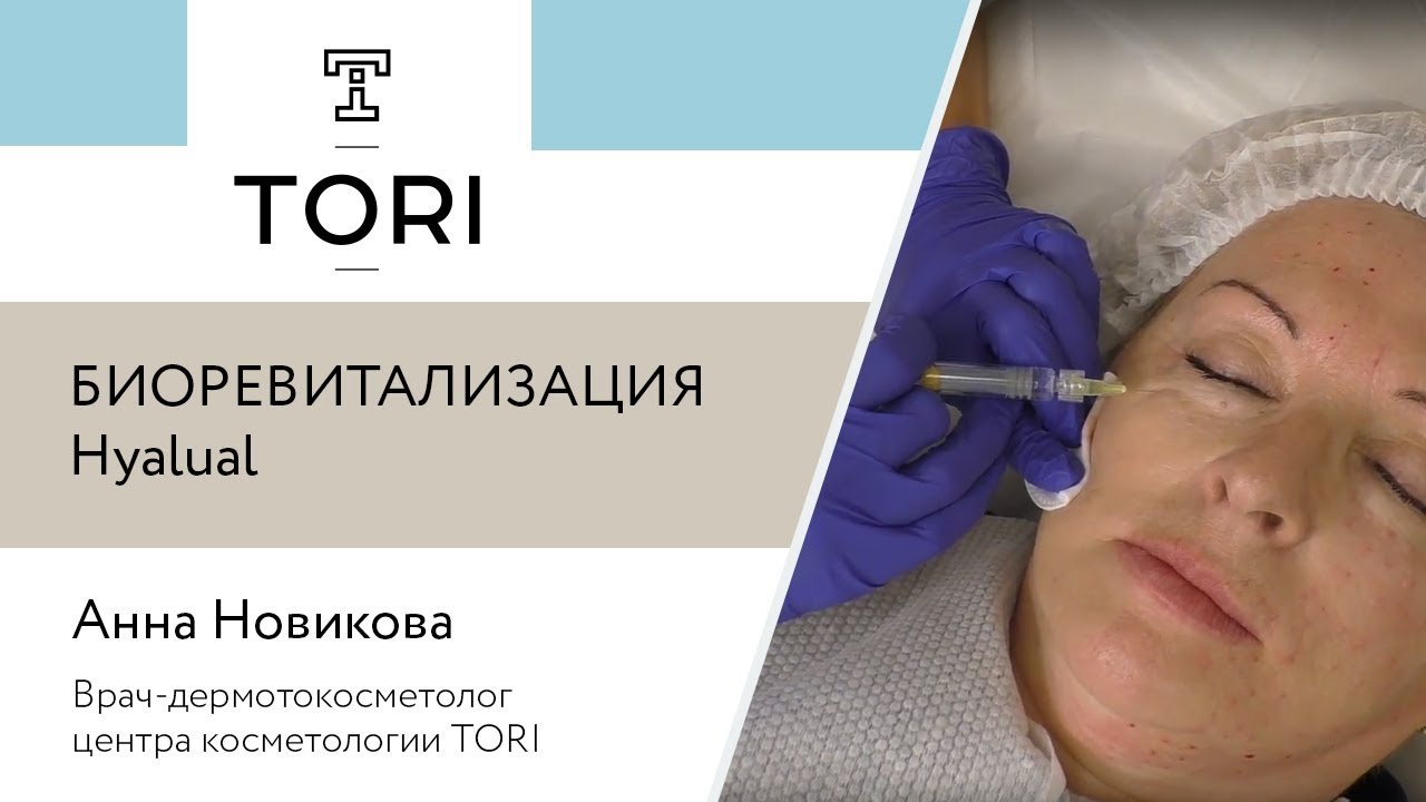 Биоревитализация Hyalual
