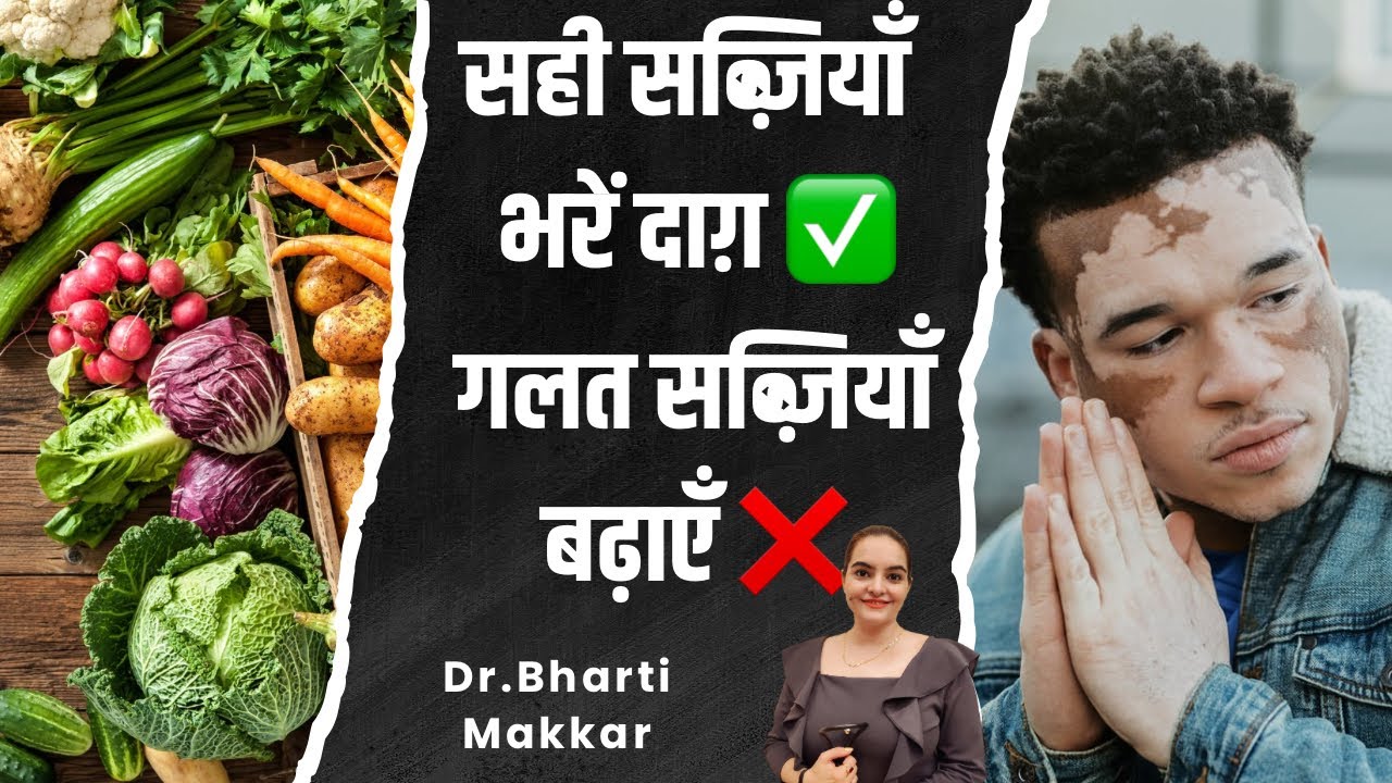 Leucoderma Diet: Vegetables You Should Eat and Avoid | Dr. Bharti Makkar