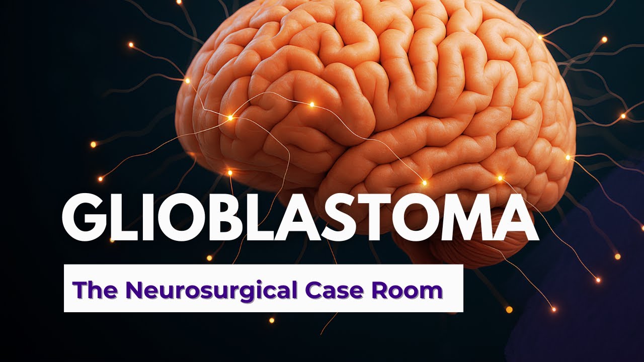 Glioblastoma | Classification, Imaging Pitfalls & Case-Based Diagnosis (Part 1)