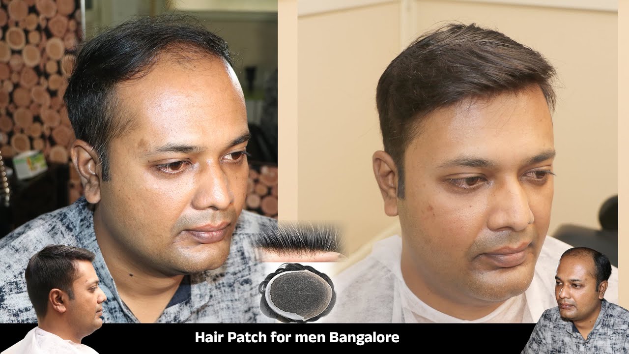 Simple Hair Style Patch for Men Customized Hair Patch Video In Bangalore Cal 9110221804 / 9742549827