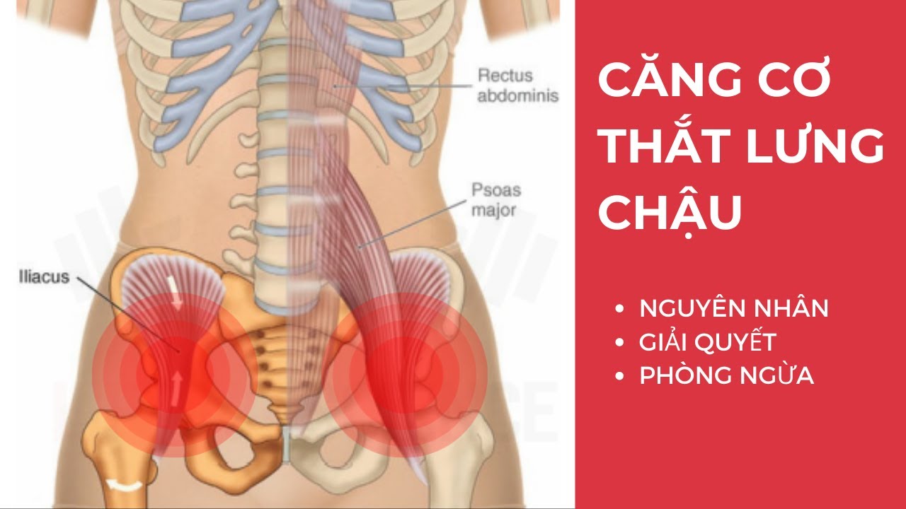 CĂNG CƠ THẮT LƯNG CHẬU - NGUYÊN NHÂN - GIẢI QUYẾT - PHÒNG NGỪA