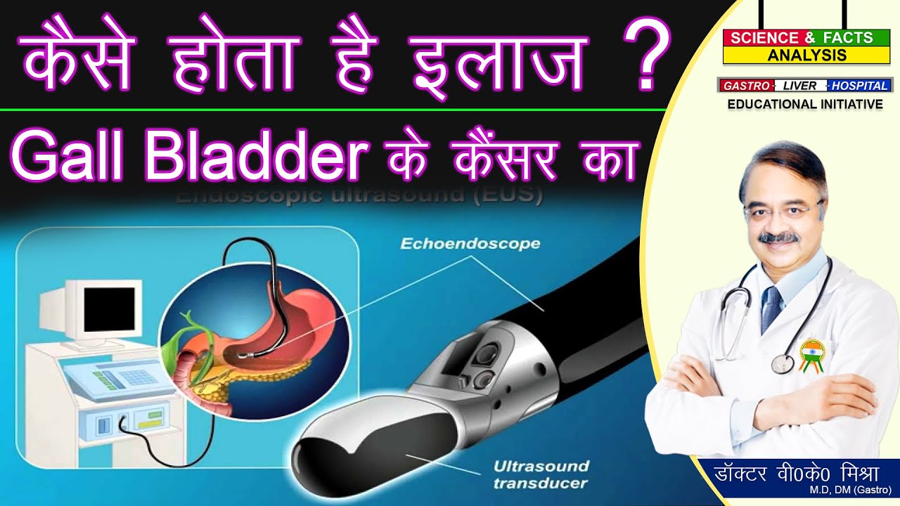 कैसे होता है इलाज GALL BLADDER  के कैंसर का || GALL BLADDER CANCER TREATMENT