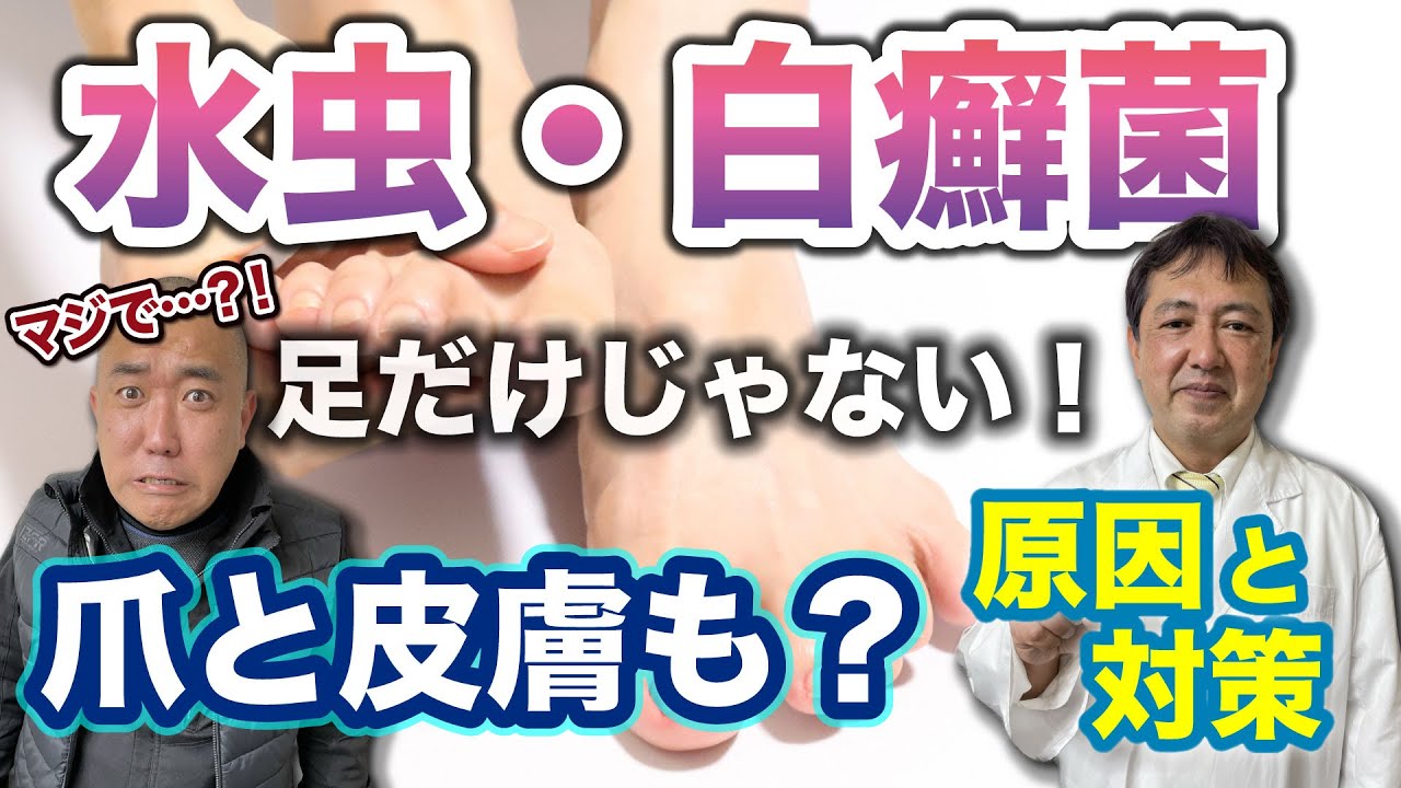 【水虫・白癬菌】気をつけないと24時間で感染する！【カビ・爪白癬】カビ取りカビ対策のカビバスターズ