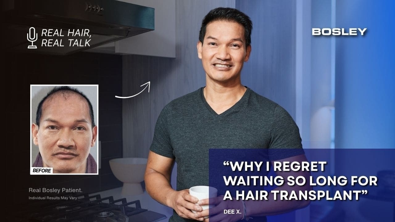 My Friends Got Hair Transplants Overseas… They Wasted Their Money