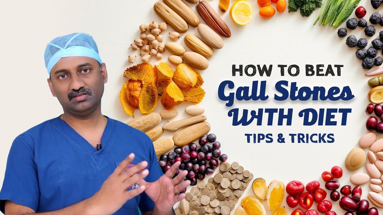 Best Diet tips for Gallstones! | Dr Parthasarathy #Gallstonestips
