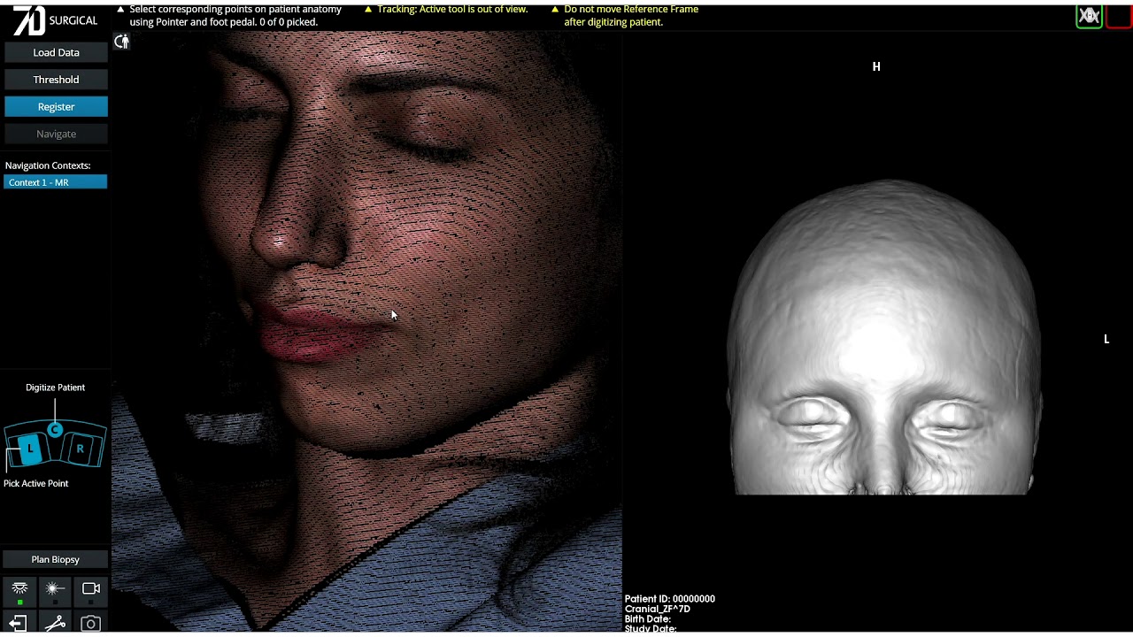 7D Surgical System &ndash; Cranial Workflow Demonstration
