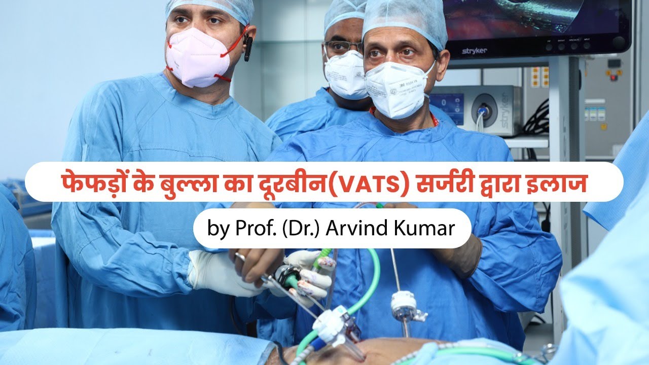 Giant Bulla surgical resection by VATS (Key-Hole) Surgery | Patient Testimonial | Dr. Arvind Kumar
