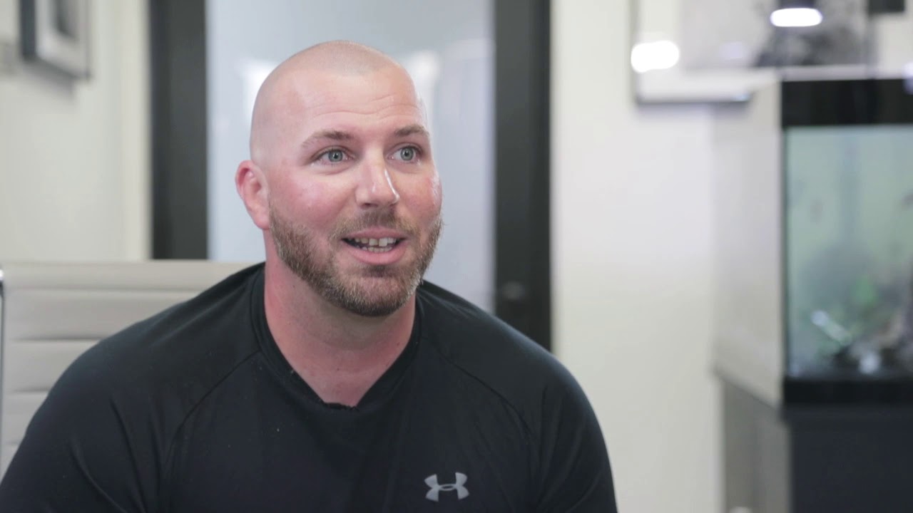 Scalp Society Testimonial | Matthew