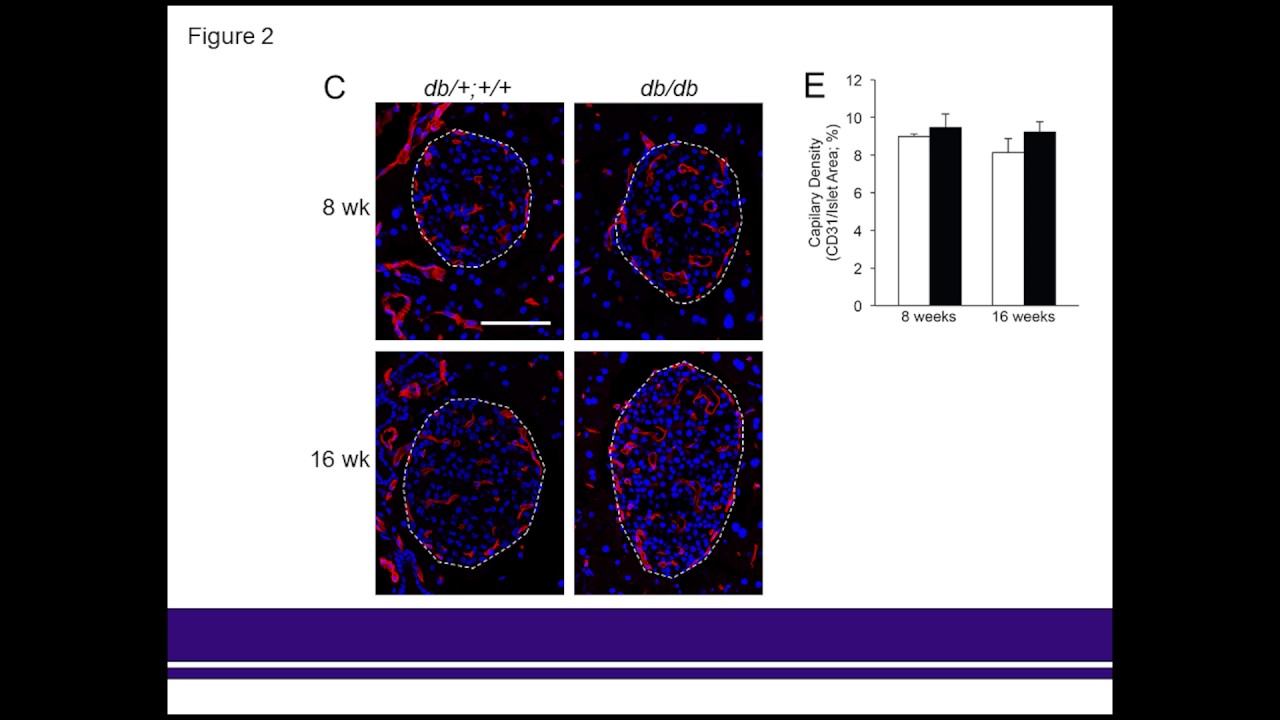 Dr. Hogan on Markers of Islet Endothelial Dysfunction